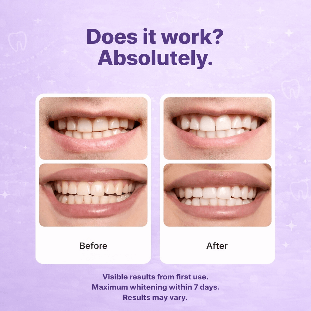 V34 Whitening Strips (14 Pairs)